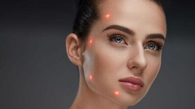 Kas yra dalinis odos atjauninimas