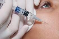Biorevitalizacijos procedūra